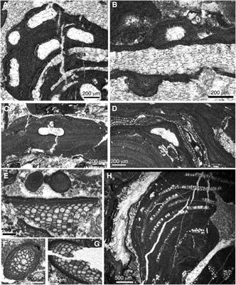 Middle Miocene (Serravallian) rhodoliths and coralline algal debris in carbonate ramps (Betic Cordillera, S Spain)